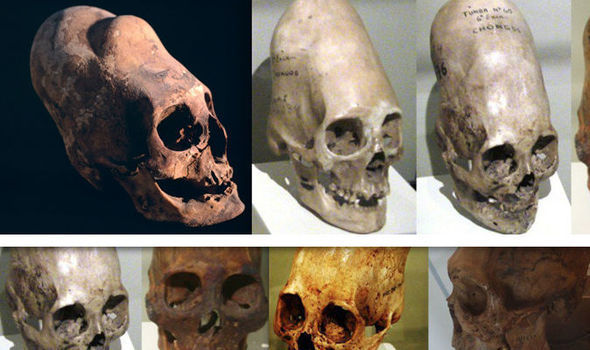 DNA Tests Reveal Where ‘Elongated Heads Came From’